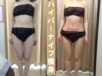 Hatten Beauty Park 810 神戸店